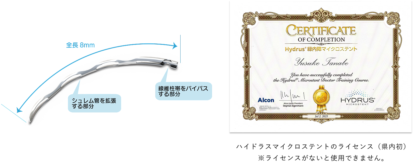 ハイドラスマイクロステントとは？
