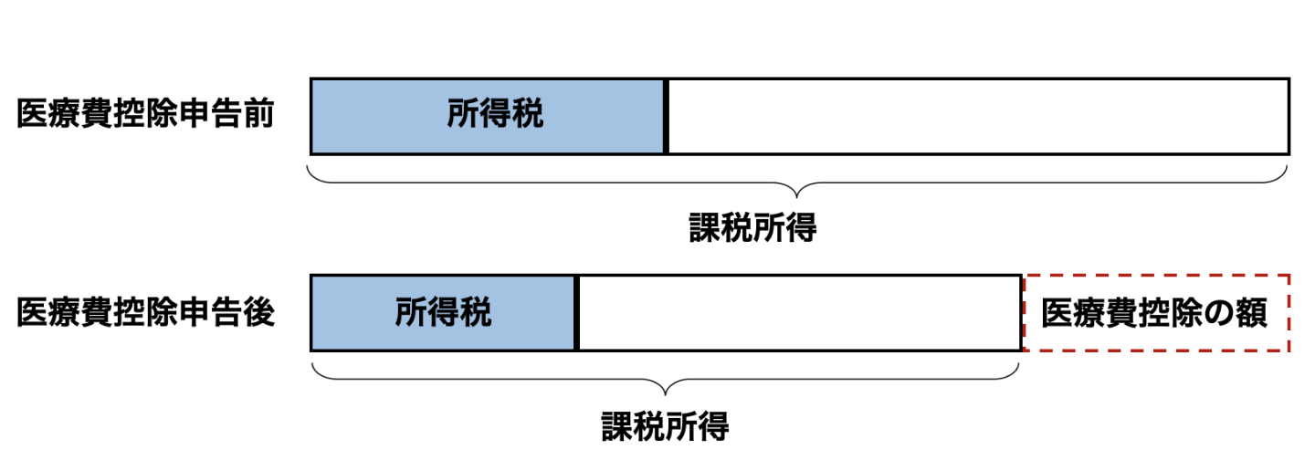 医療費控除グラフ