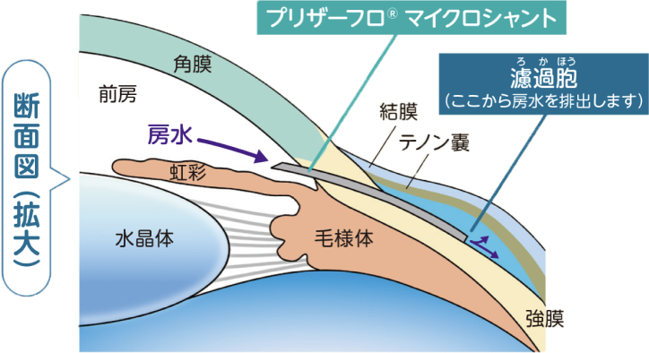 断面図（拡大）