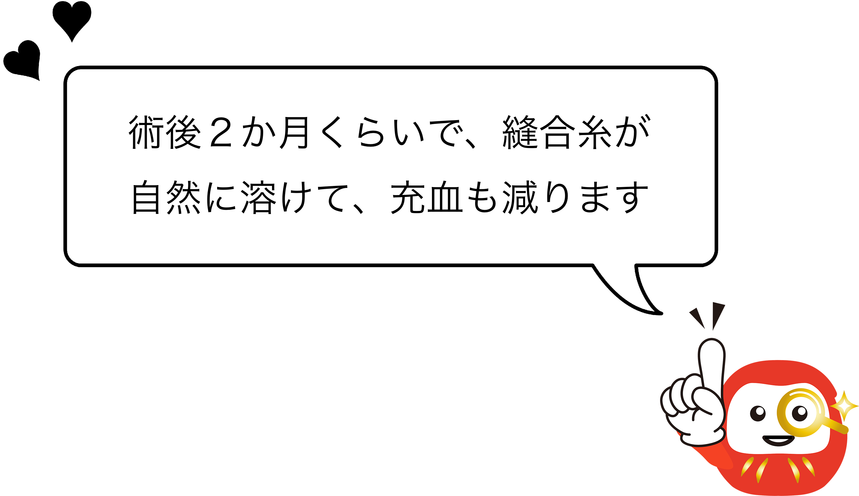 術後２か月くらいで、縫合糸が自然に溶けて、充血も減ります