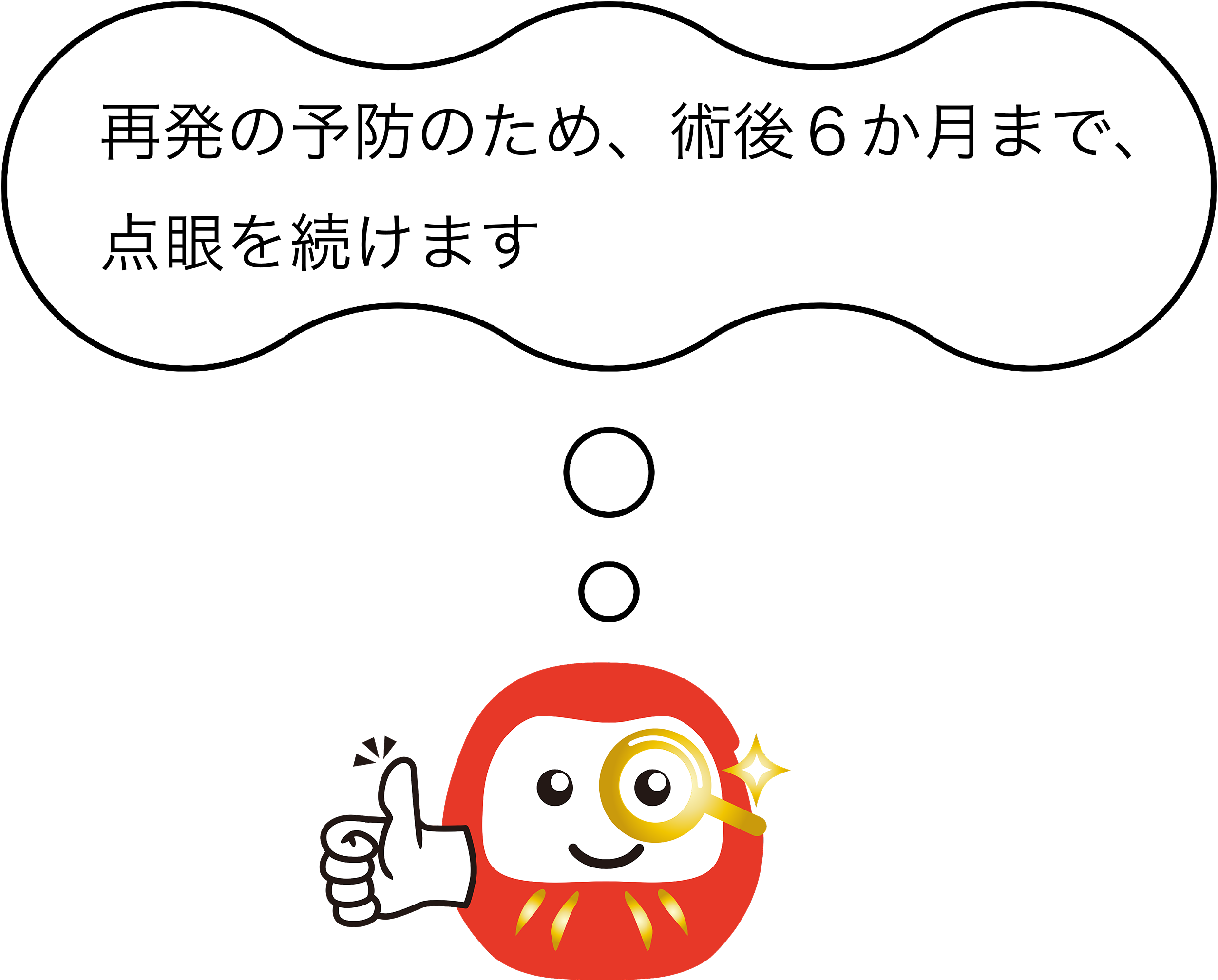 再発の予防のため、術後６か月まで、点眼を続けます